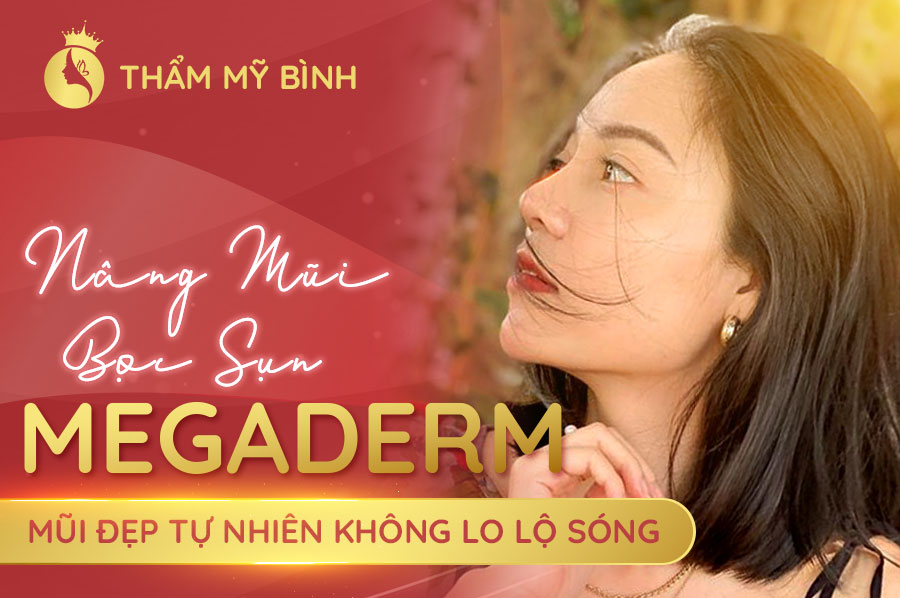 Nâng-Mũi-Bọc-Sụn-Megaderm---Mũi-đẹp-tự-nhiên-không-lo-lộ-sóng