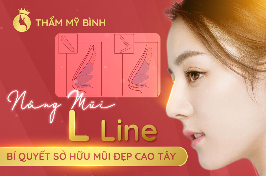 Nâng-Mũi-L-Line---Bí-Quyết-Sở-Hữu-Mũi-Cao-Tây
